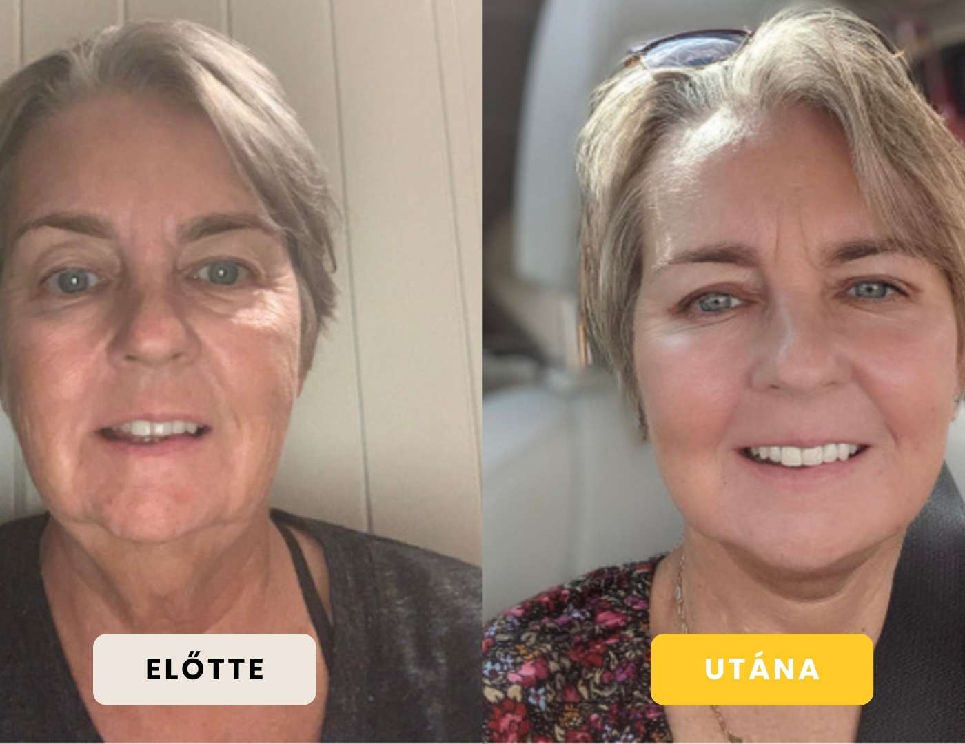 Feszesítő Popsi és Comb Krém